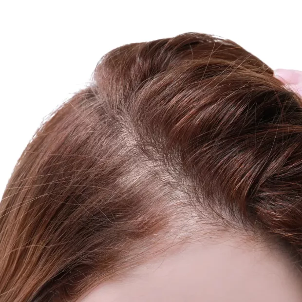 Thinning Hair