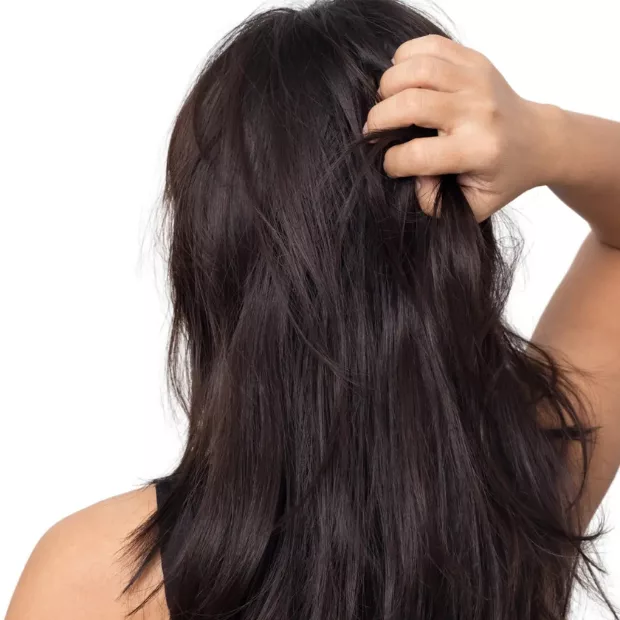 Hair Loss